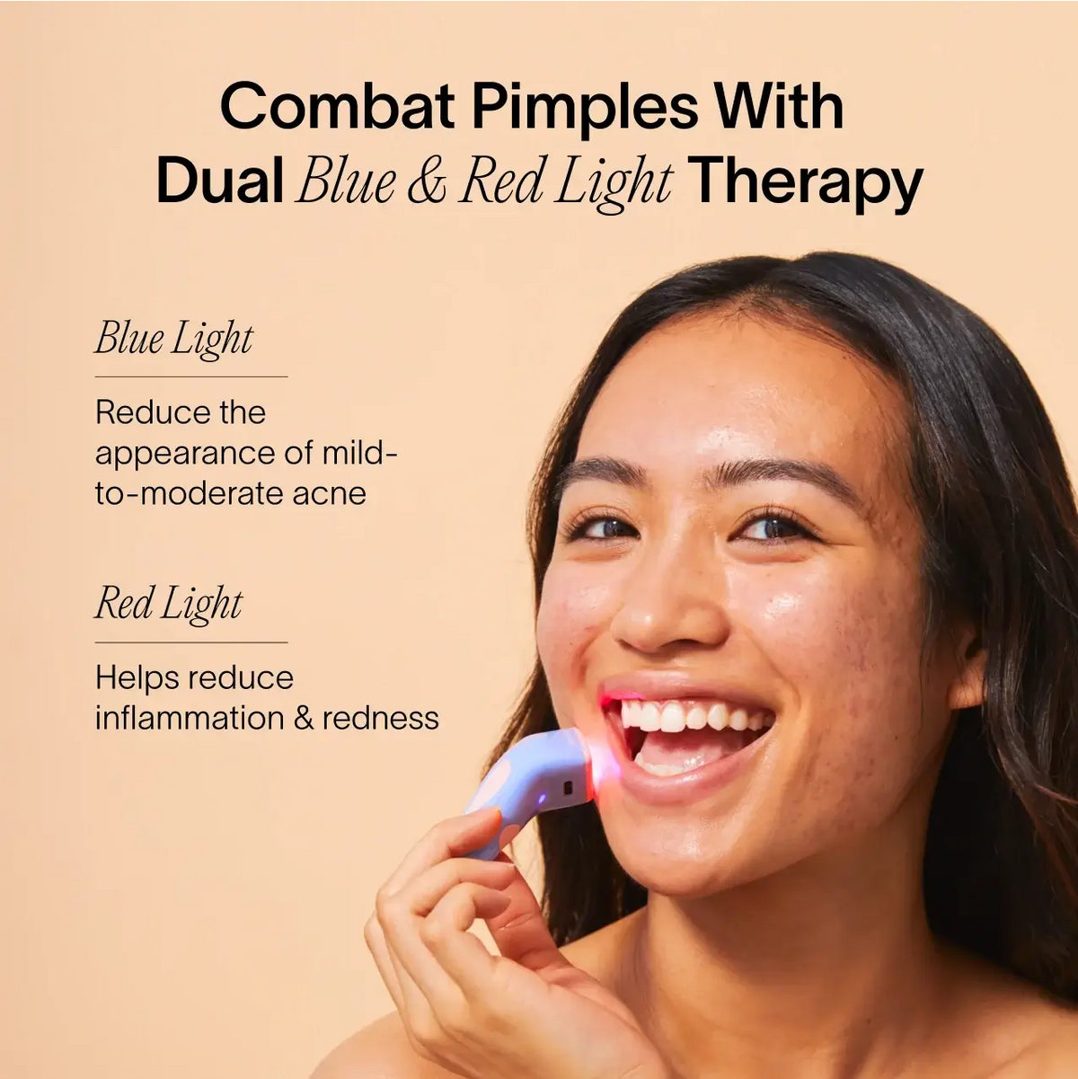 Solawave Bye Acne 3-Minute Pimple Spot Treatment skincare tool in periwinkle for quick acne spot treatment.