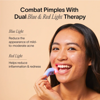 Solawave Bye Acne pimple spot treatment tool in periwinkle, designed for quick acne spot treatment using skincare tools.