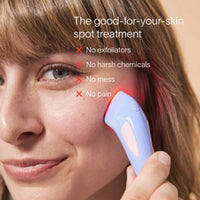 Solawave Bye Acne 3-Minute Pimple Spot Treatment in periwinkle, a skincare tool for fast acne spot treatment.