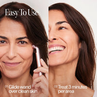 Solawave 4-in-1 red light therapy wand and activating serum kit in rose gold for skincare and facial rejuvenation.