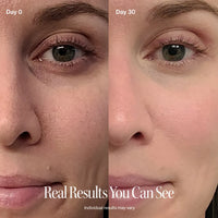 Solawave 4-in-1 red light therapy wand and activating serum kit in rose gold for skincare and skin rejuvenation.